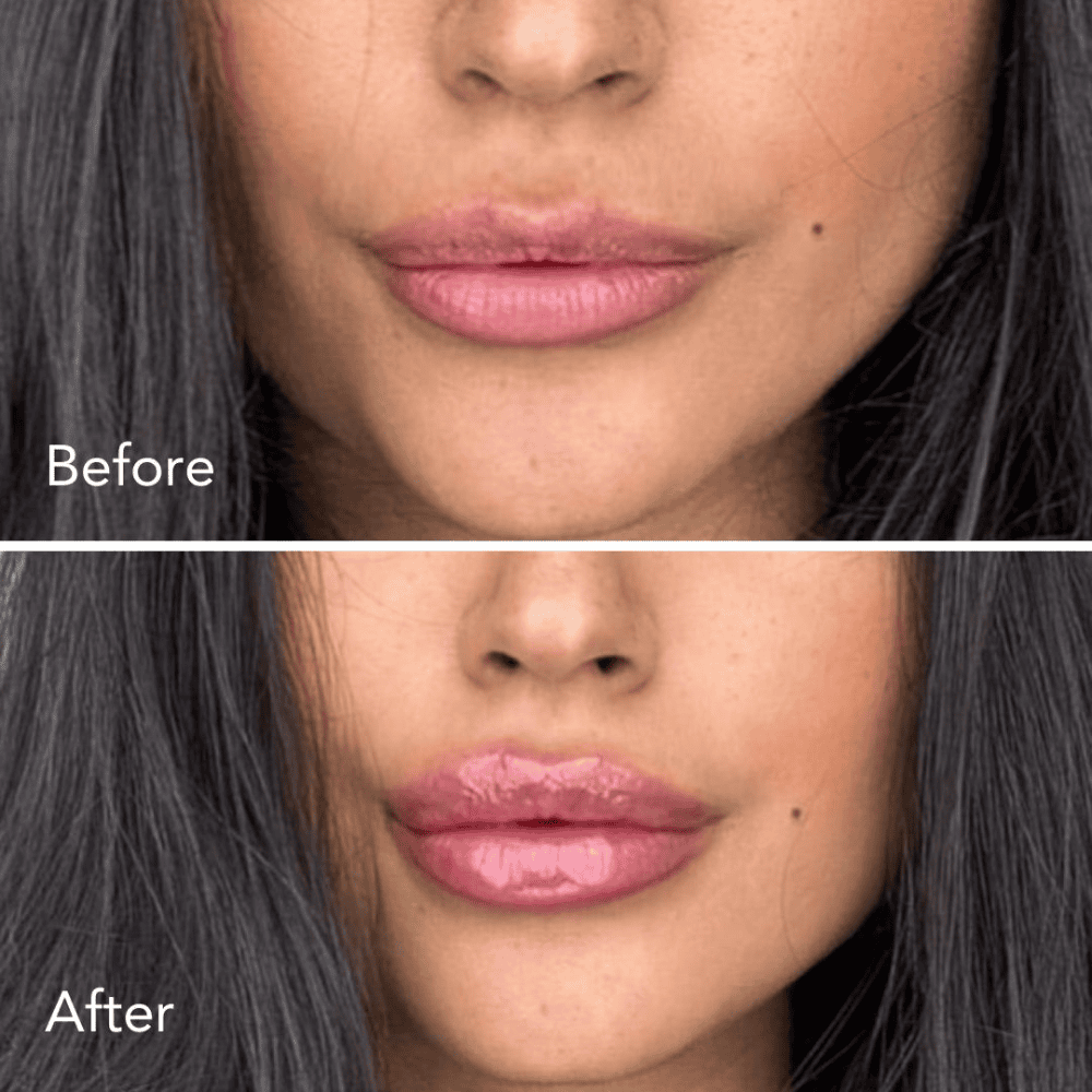 FullMoon™ Lip Plumper – Voor Volle & Verleidelijke Lippen