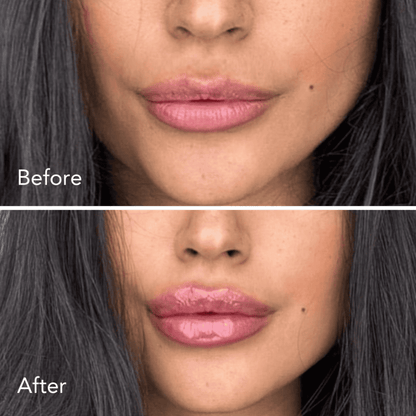FullMoon™ Lip Plumper – Voor Volle & Verleidelijke Lippen