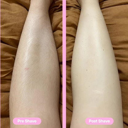 SilkLady Pro™ | Voor een Gladde Huid Zonder Irritatie – Draadloos & Waterdicht Scheerapparaat