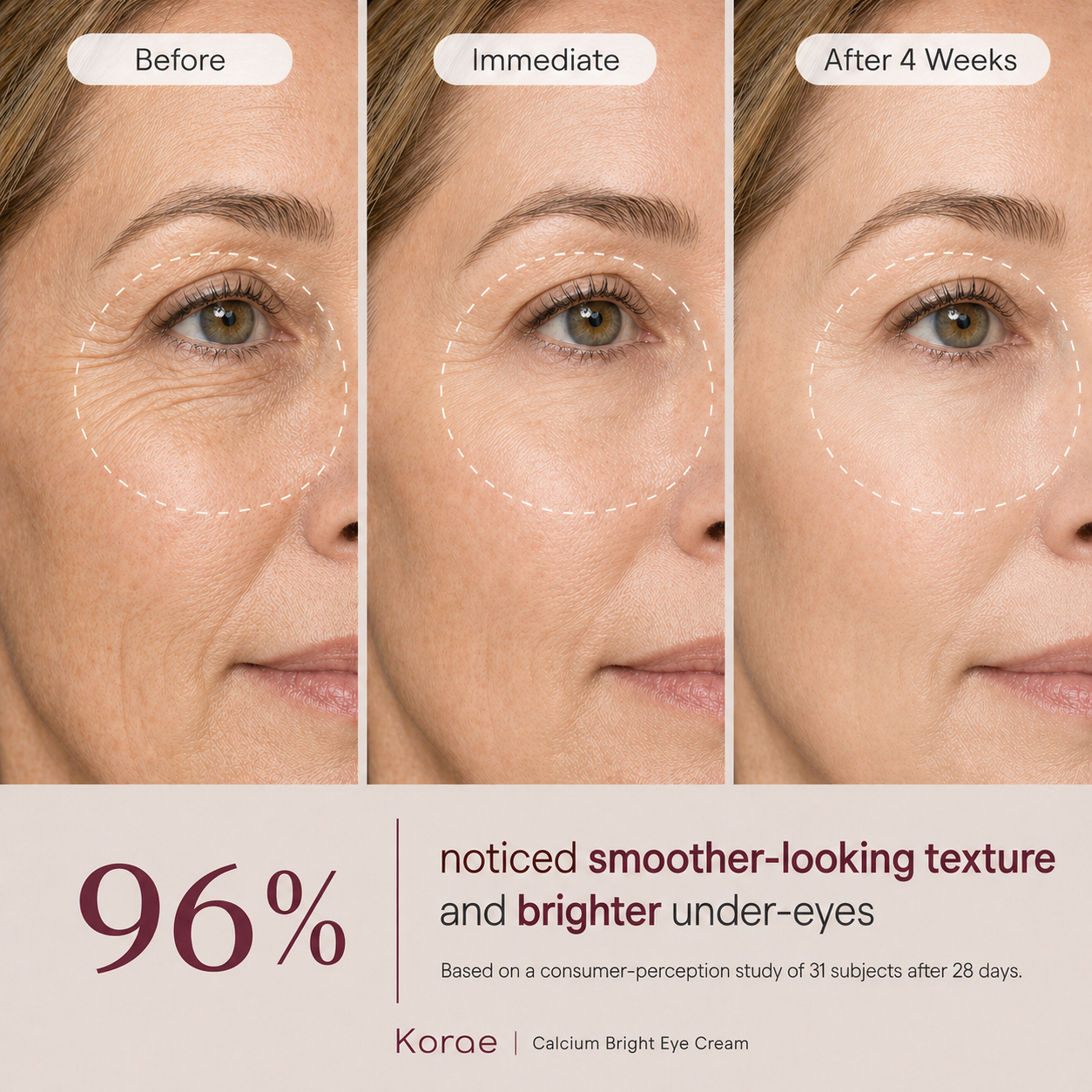 MI'VORA Koreaanse Calcium Bright Oogcrème | Verheldert, egaliseert en perfectioneert
