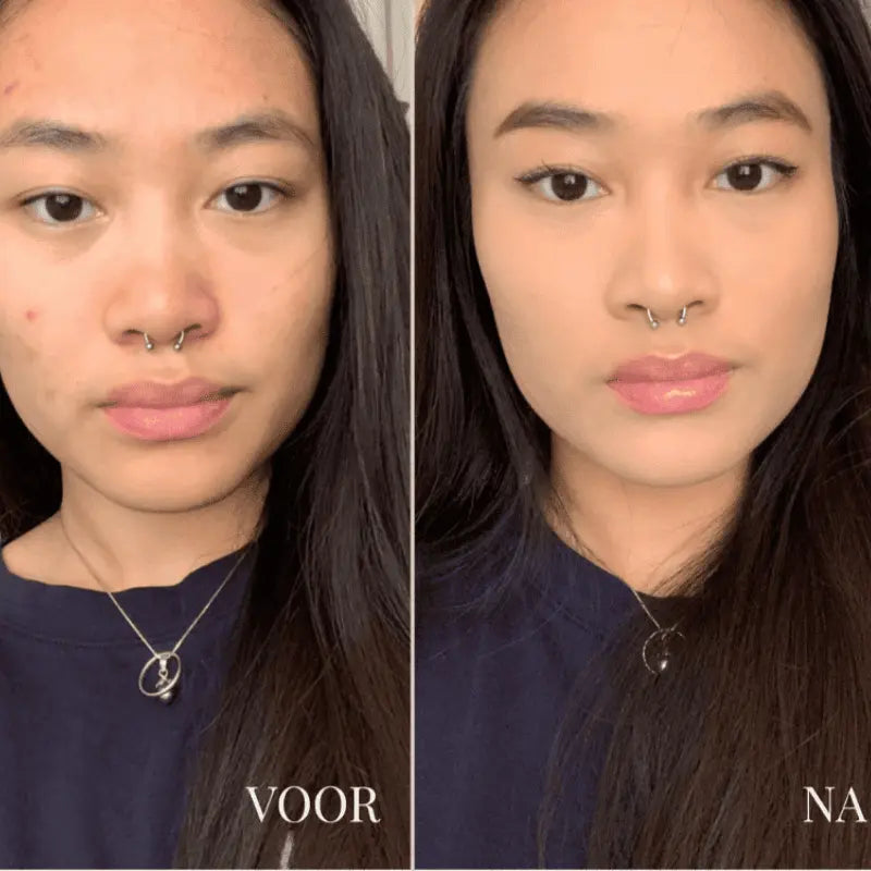 SOS Cover™ Color Correcting Concealer | Hydraterend voor Undereye & Roodheid + Gratis Brush MI'VORA