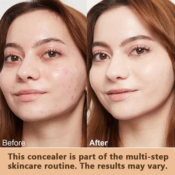 MagicMatch™ | De Foundation Stick die zich aanpast aan jouw huidskleur! 1+1 GRATIS = 80% KORTING!