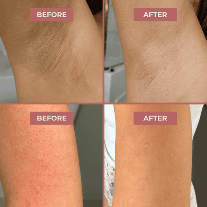 MI'VORA Body Peeling Spray voor een egale, verzorgde lichaamshuid