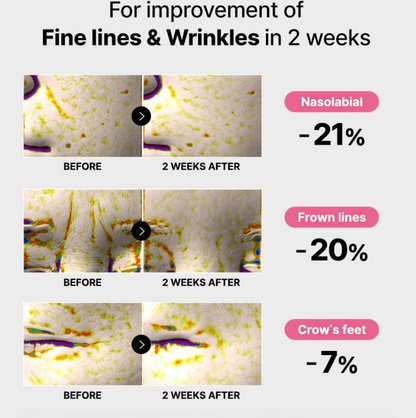 MIVORA Collagen EyePatch