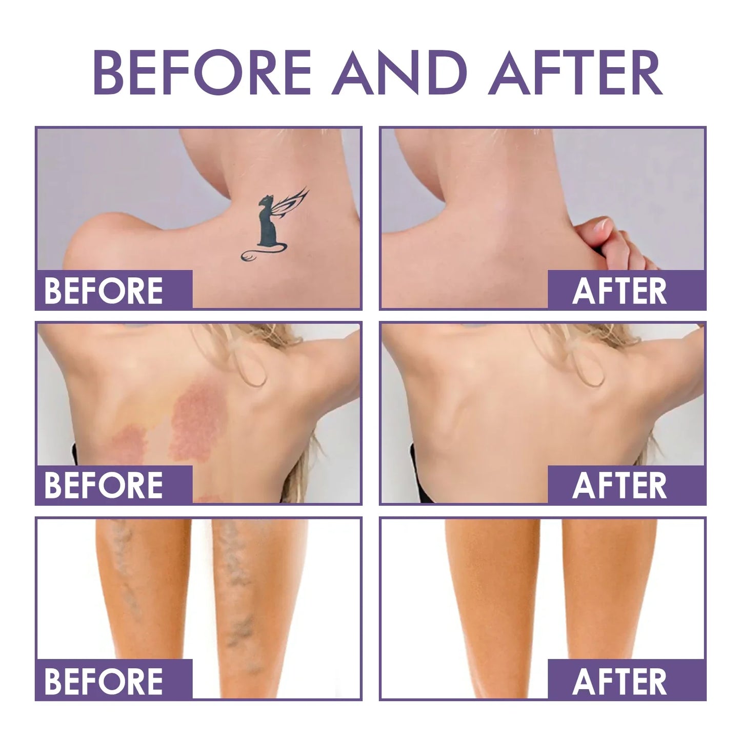 MI'VORA Body Perfector