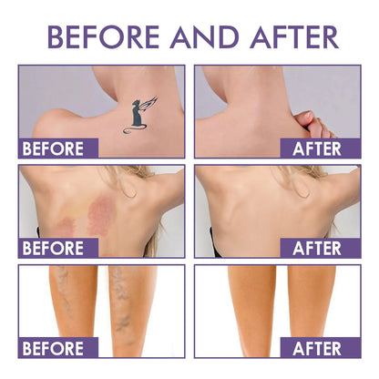 MI'VORA Body Perfector