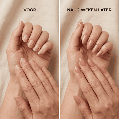 MI'VORA NailRomance™ | Assortimentsset van 4 kleuren | UV-vrije gelnagelstickers. De mooiste gelnagels zonder UV-lamp of nagelsalon.