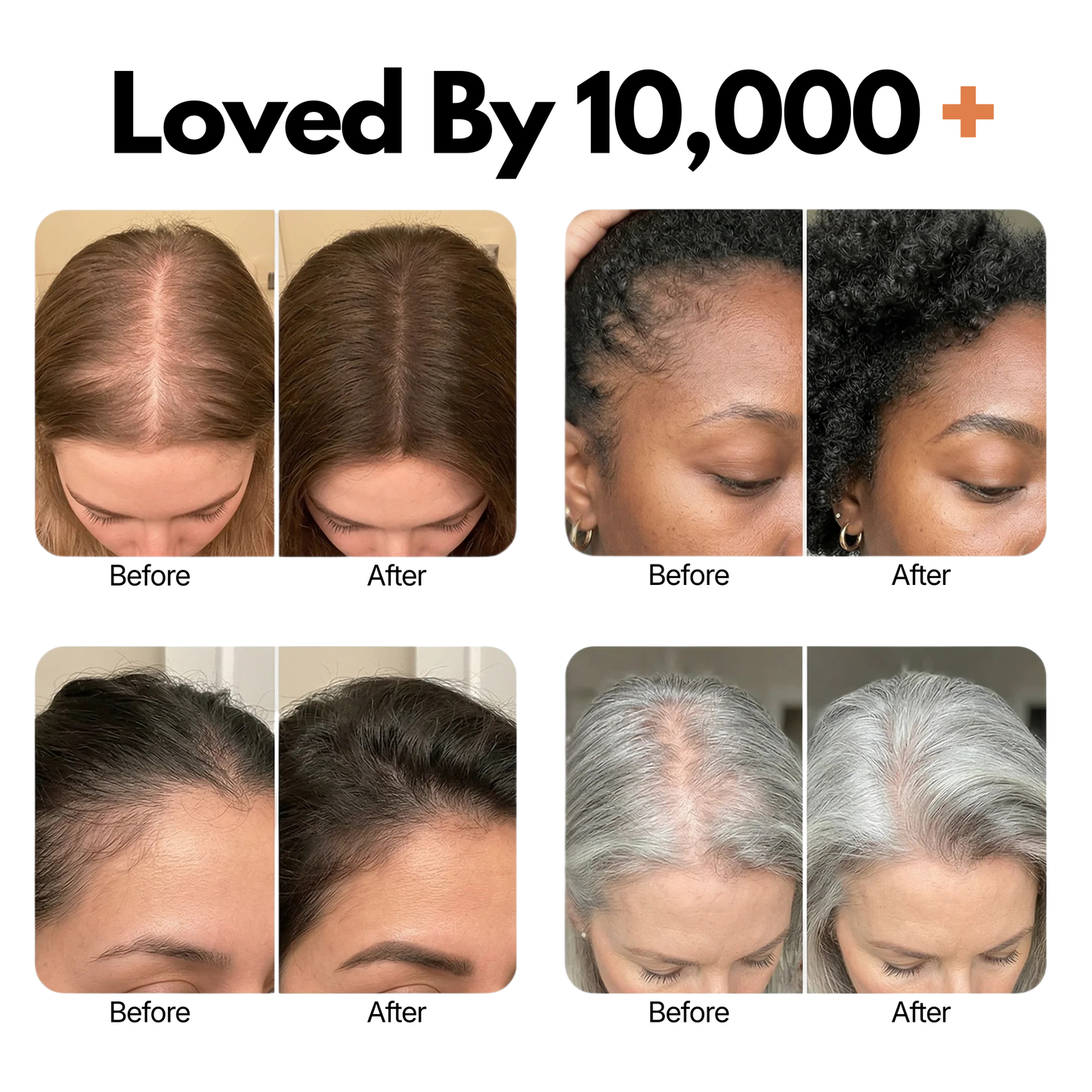 MI'VORA Avera™ | Korea's Nr. 1 Serum voor Haargroei