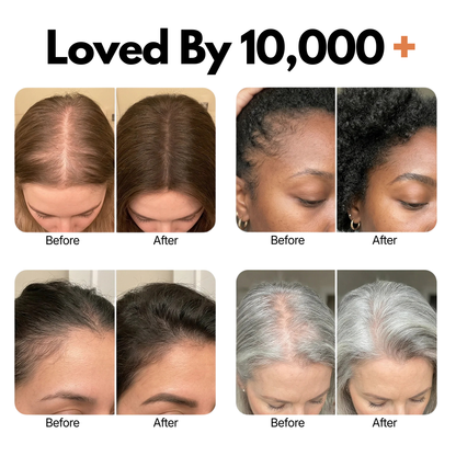 MI'VORA Avera™ | Korea's Nr. 1 Serum voor Haargroei